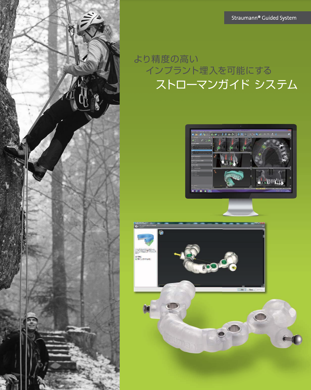 ストローマンインプラント