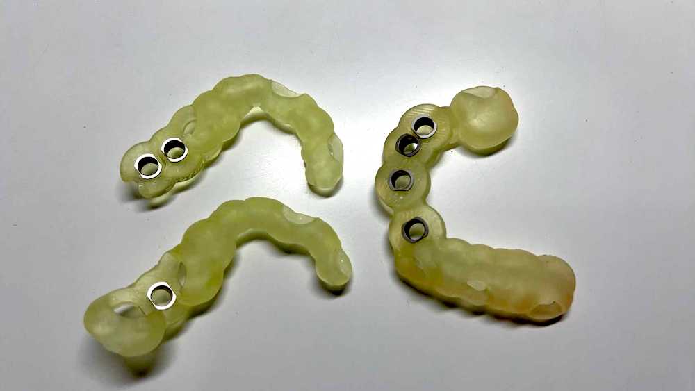 ストローマンインプラントガイド